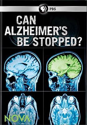 Can Alzheimer's be stopped?